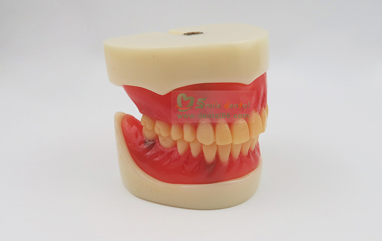Full Denture Implant Mode